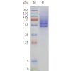 page-flp120330 hrh1 strep sp1