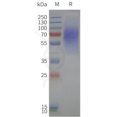 page-flp120334 lpar1 strep sp1 1