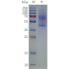 page-flp120336 lpar3 strep sp1