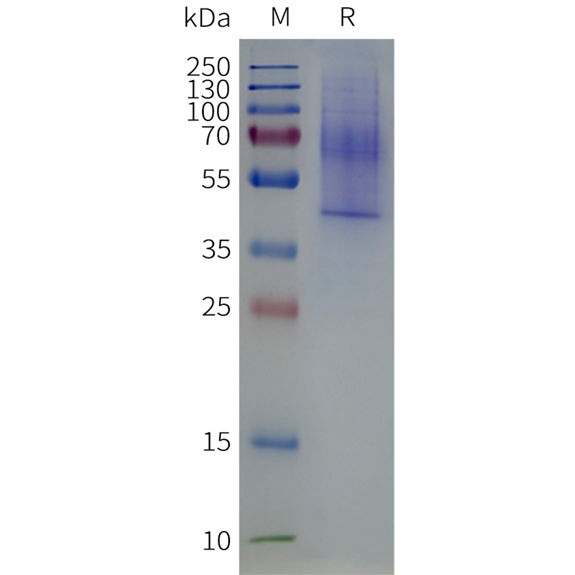 page-flp120336 lpar3 strep sp1