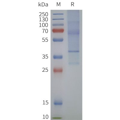 page-flp120338 lpar5 strep sp1