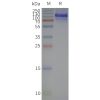page-flp120340 lshr strep sp1