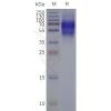 page-flp120341 ltb4r strep sp1