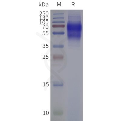 page-flp120341 ltb4r strep sp1