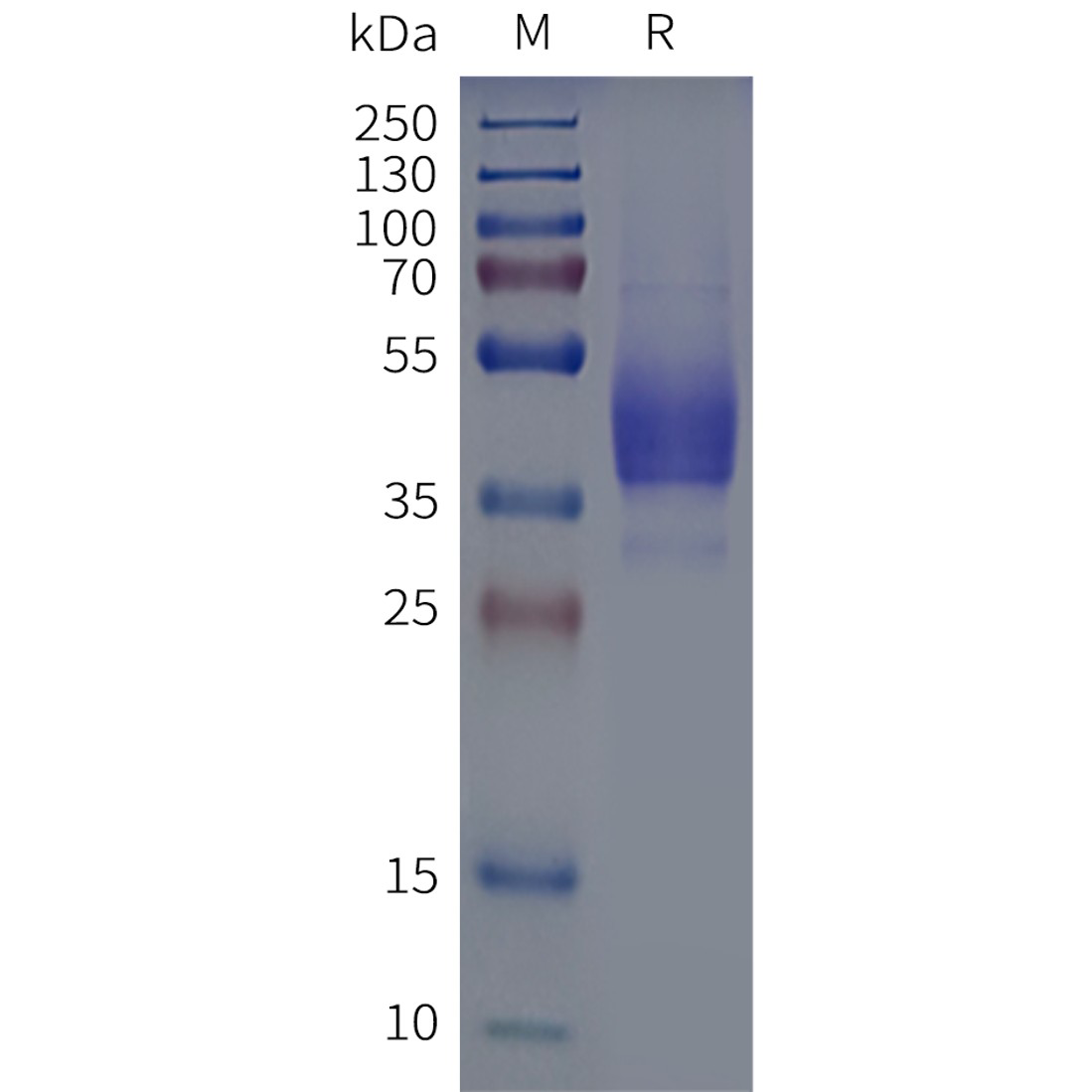 page-flp120351 mrgprx1 strep sp1