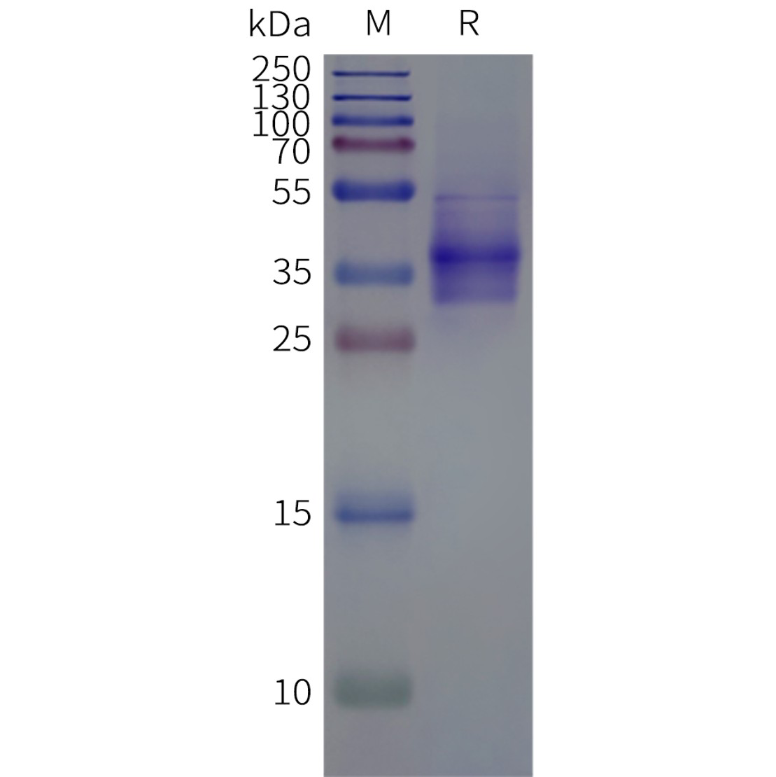 page-flp120353 mrgprx4 strep sp1