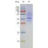 page-flp120356 mtr1a strep sp1 1