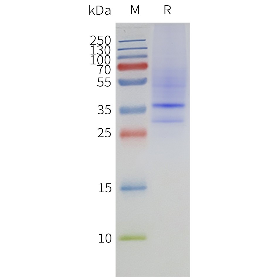 flp120356-mtr1a-strep-sp1.jpg