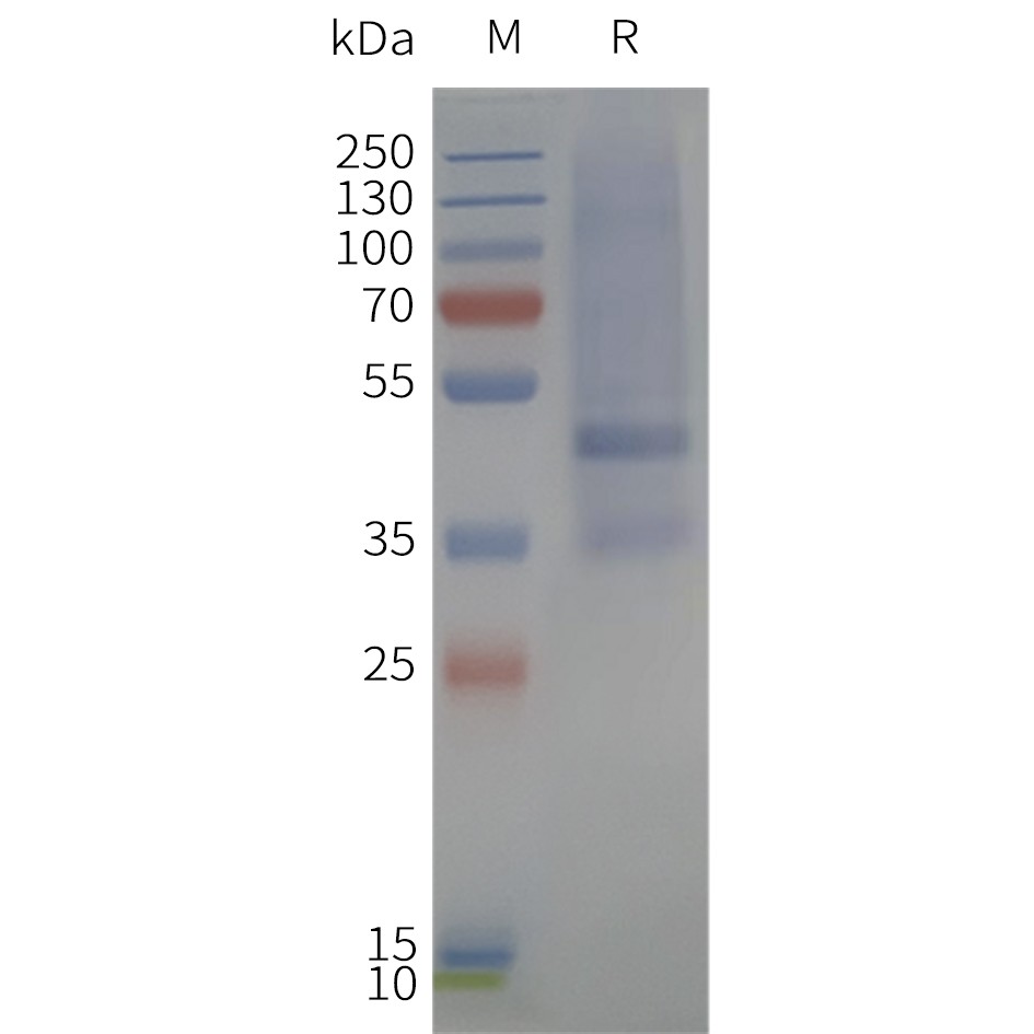 flp120357-mtr1b-strep-sp1.jpg