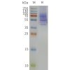 page-flp120361 nk3r strep sp1