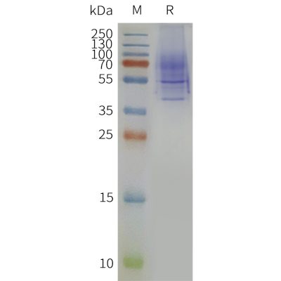 page-flp120361 nk3r strep sp1
