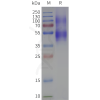 page-flp120370 npy1r strep sp1