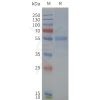 page-flp120371 npy2r strep sp1