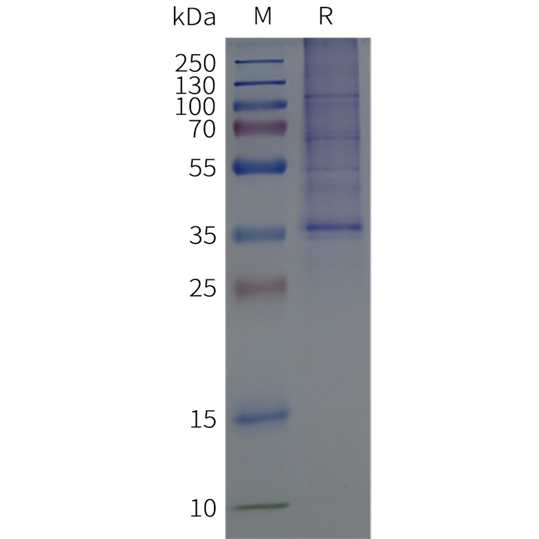 page-flp120378 gpr68 strep sp1