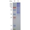 page-flp120382 oprd1 strep sp1