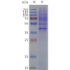 page-flp120429 oxyr strep sp1
