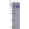 page-flp120440 pacr strep sp1