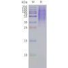 page-flp120447 ptgir strep sp1