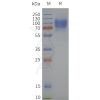 page-flp120451 pth1r strep sp1