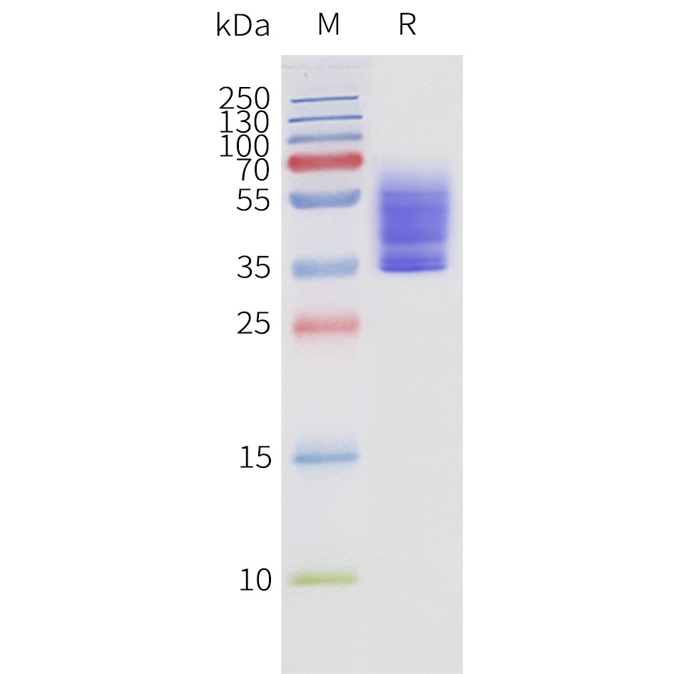 flp120462-s1pr3-strep-sp1.jpg