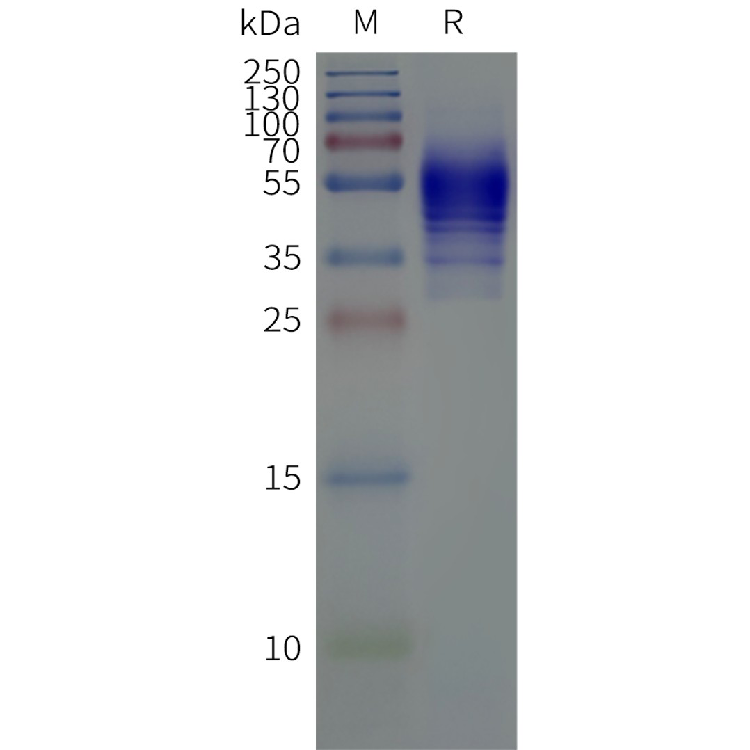 flp120464-s1pr5-strep-sp1.png