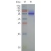 page-flp120465 sctr strep sp1