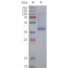 page-flp120467 sstr1 strep sp1