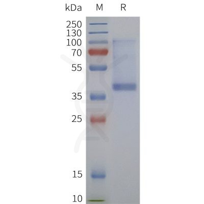 page-flp120467 sstr1 strep sp1