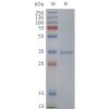 page-flp120473 tas2r38 strep sp1