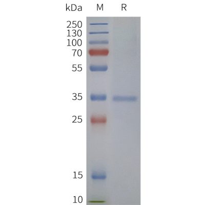 page-flp120473 tas2r38 strep sp1