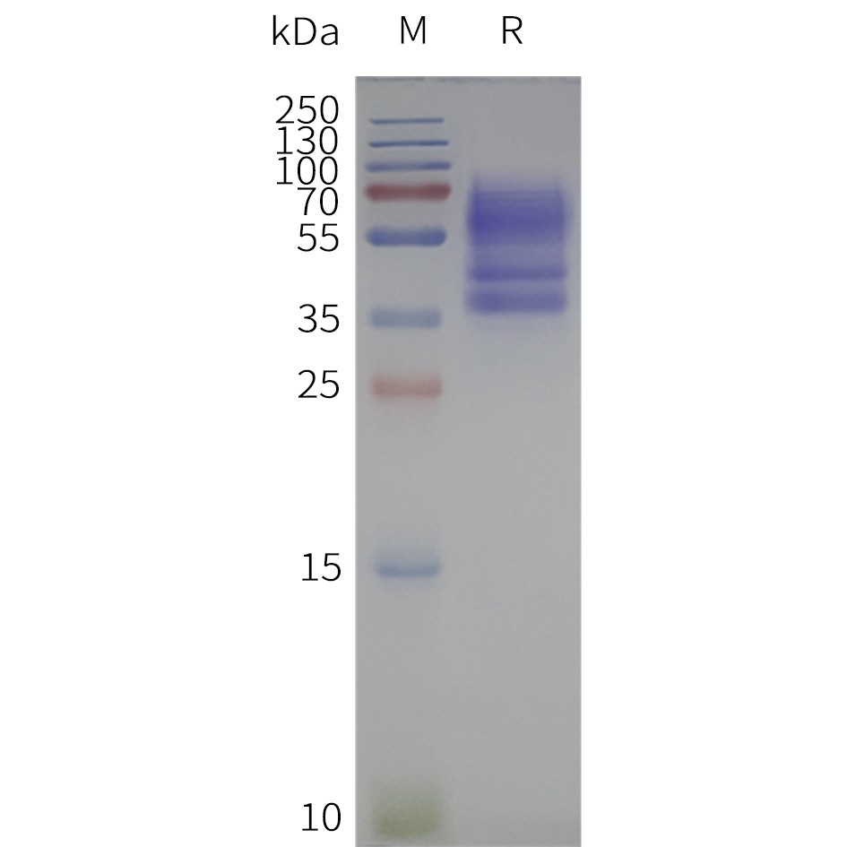 flp120492-avpr2-strep-sp1.jpg