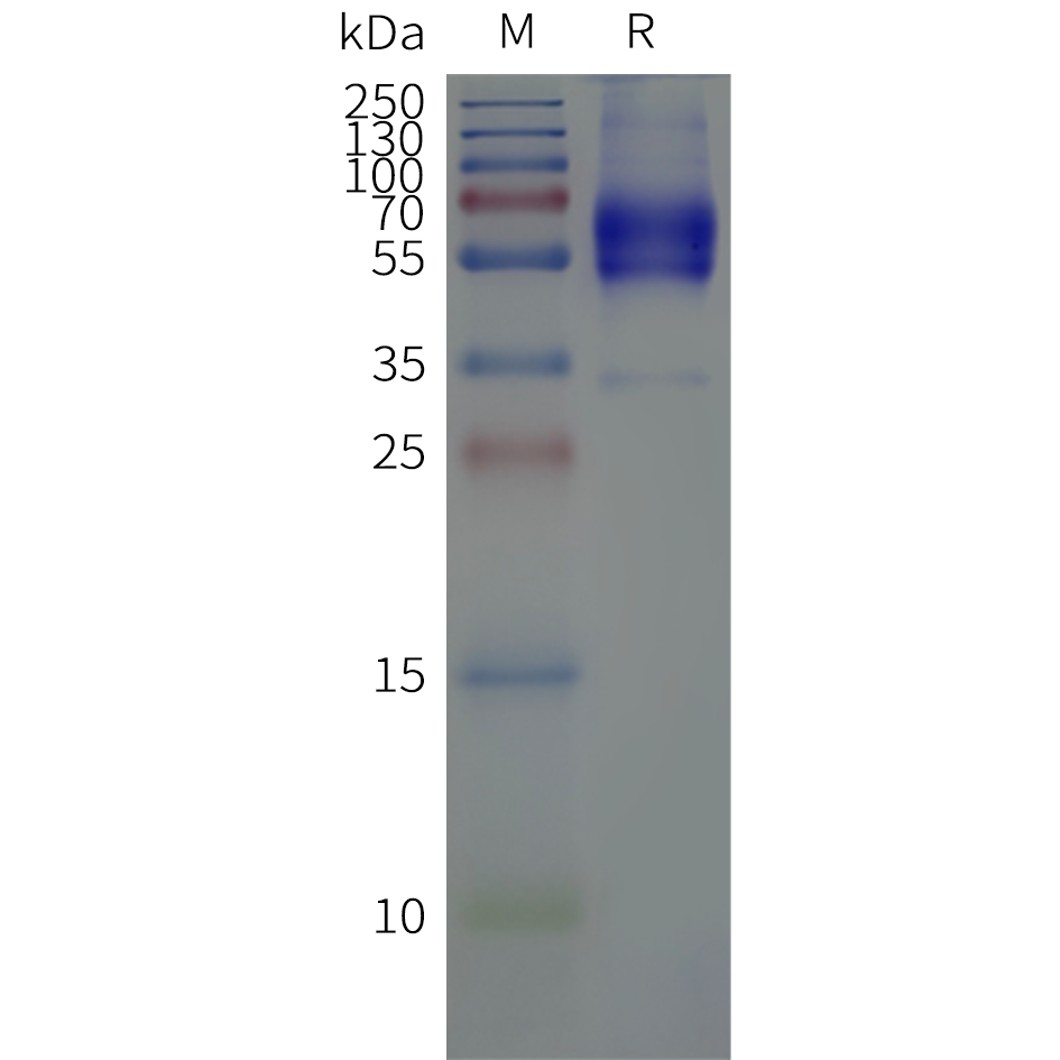 flp120494-vipr2-strep-sp1.png