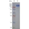 page-flp120496 slc34a2 strep sp1