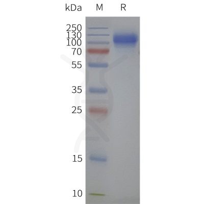 page-flp120496 slc34a2 strep sp1