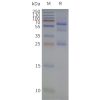 page-flp120503 cldn18.1 strep sp1
