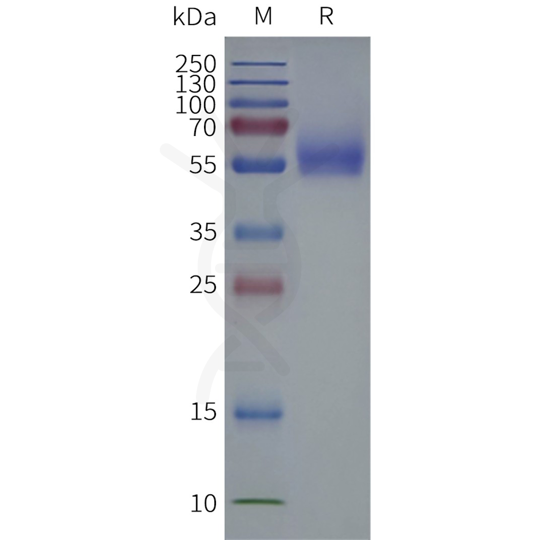 page-flp120510 slc2a1 strep sp1