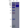 page-flp120515 flvcr1 strep sp1