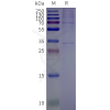 page-flp120516 or2t12 strep sp1