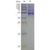 page-flp120517 kcnj1 strep sp1