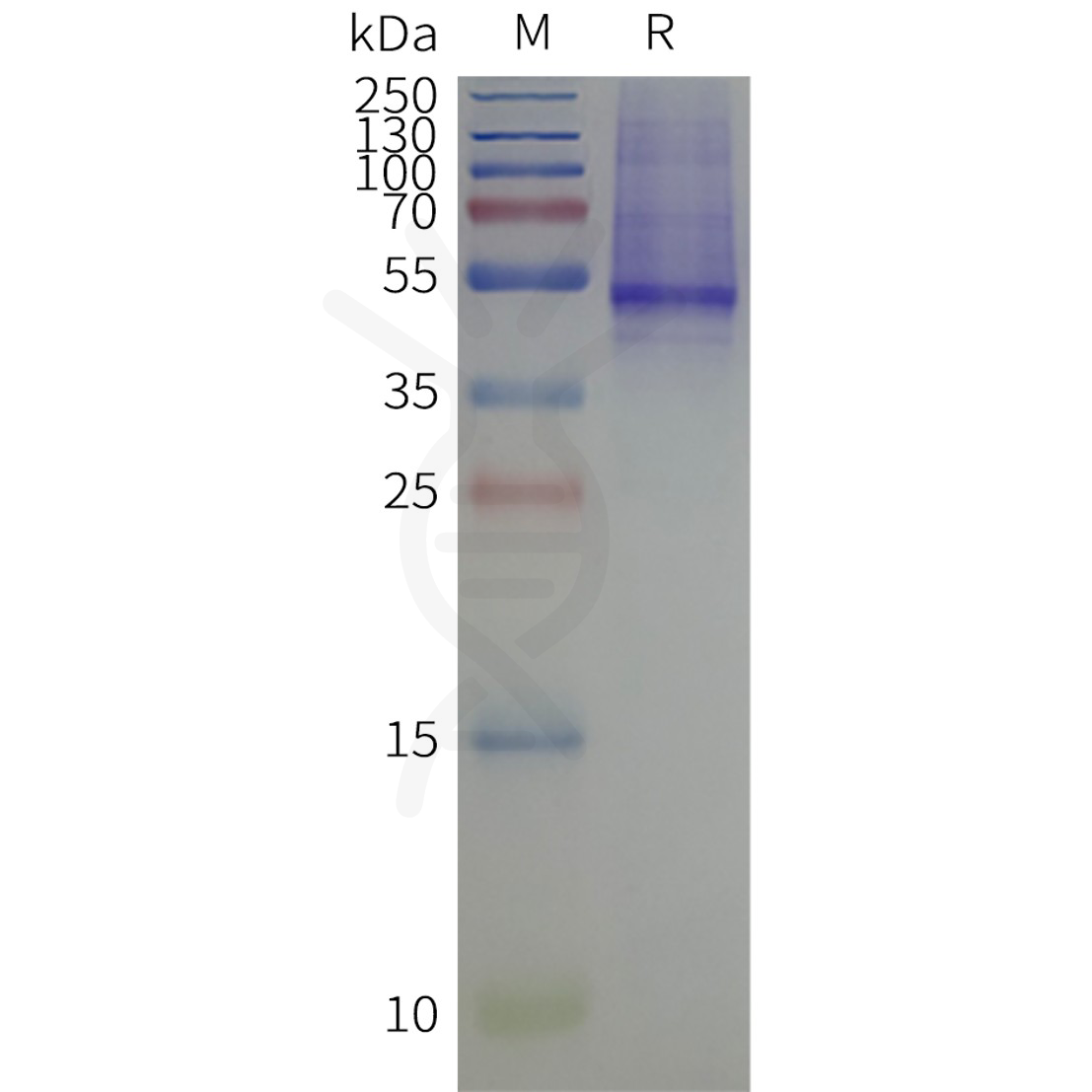 page-flp120517 kcnj1 strep sp1
