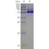 page-flp120518 kcnj3 strep sp1