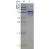 page-flp120519 kcnj4 strep sp1