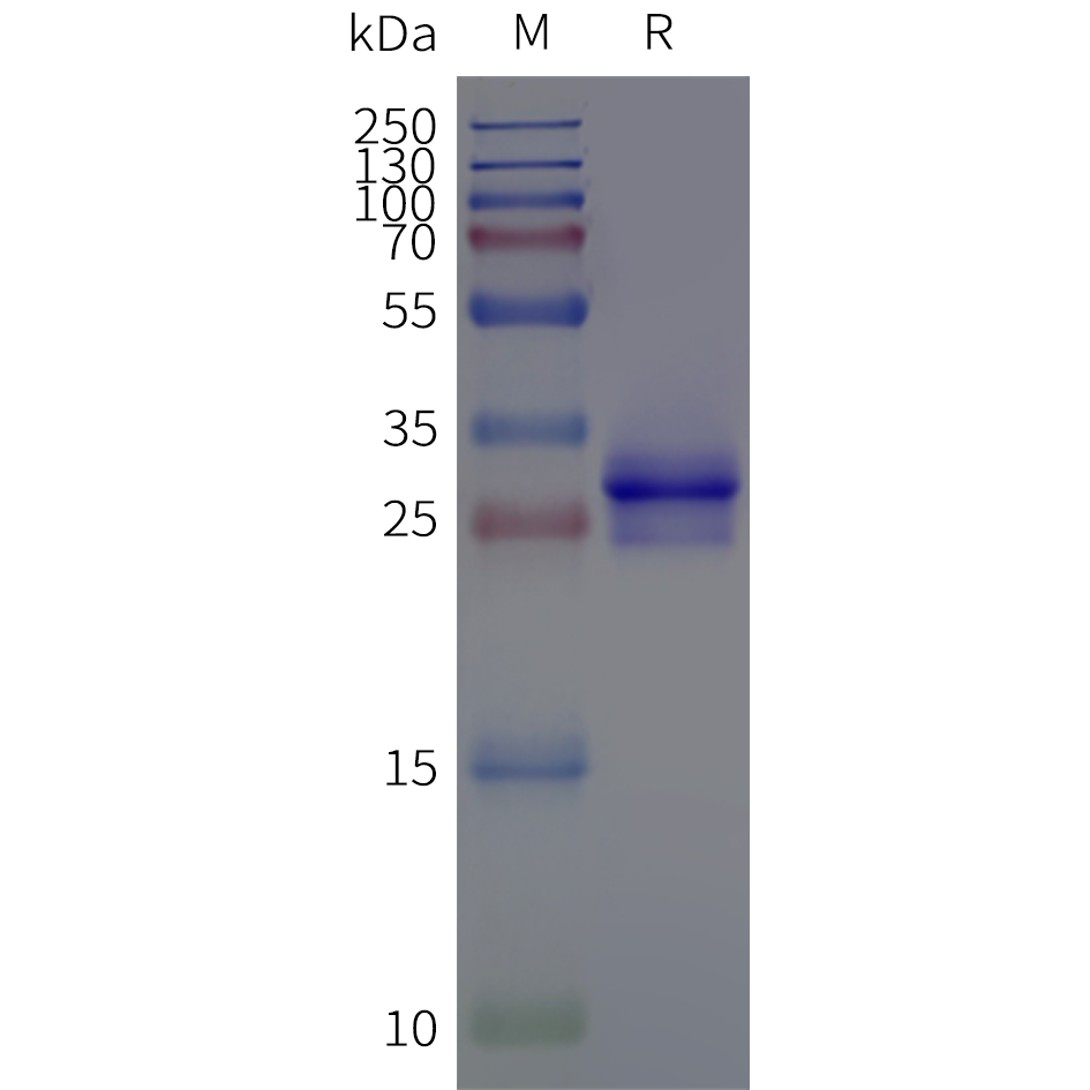 flp120521-rgr-strep-sp1.png