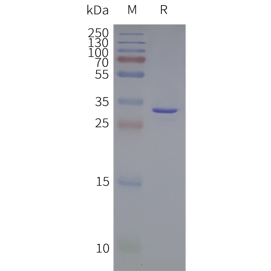 flp120647-vdac1-strep-sp1.jpg