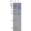 page-flp420503 cldn18.1 strep sp1