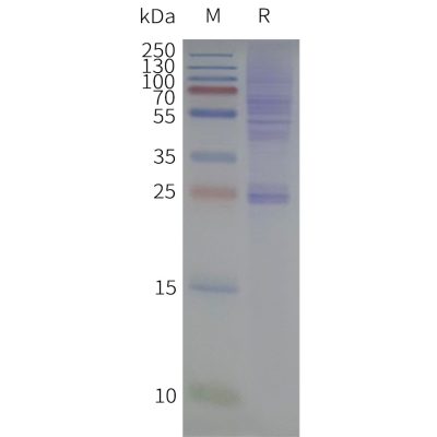 page-flp420503 cldn18.1 strep sp1