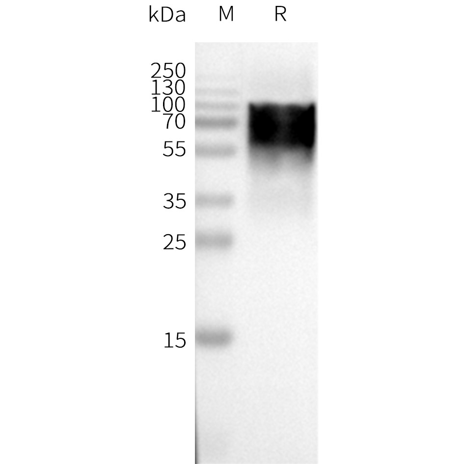 flp120031-gpr75-wb1.png