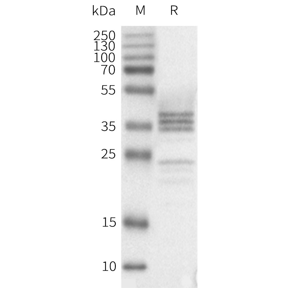 flp120092-gnrhr-strep-wb1.png