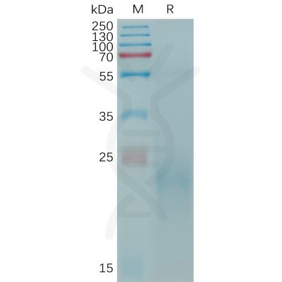 sp-PME C100013 CLEC4C Fig.1 SDS PAGE 1