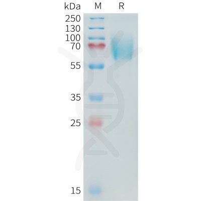 sp-PME C100018 B7 H3 Fig.1 SDS PAGE 1